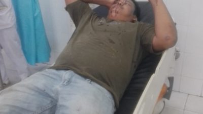 BRUTAL! DIDUGA RATUSAN OKNUM KARYAWAN PT BSP LAKUKAN PENGANIAYAAN MASSAL — KAPOLRES ASAHAN JANGAN TUTUP MATA