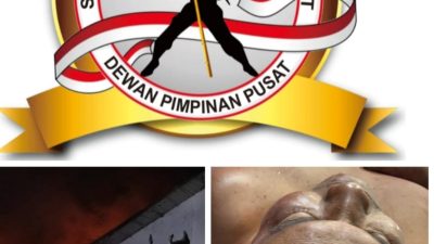 Kapolres Asahan Respons Dugaan Kekerasan di Eks HGU PT BSP: “Kami Tinjut dengan Penyelidikan”