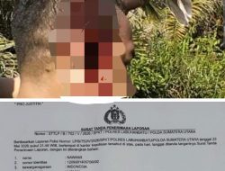 Mangkir dari Panggilan Penyidik, Korban Desak Polres Labuhanbatu Segera Tangkap Pelaku Penganiayaan 